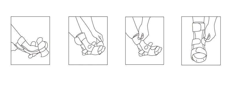 Post OP Ankle Brace Night Splint Instructions Post OP Ankle Brace Night Splint Instructions